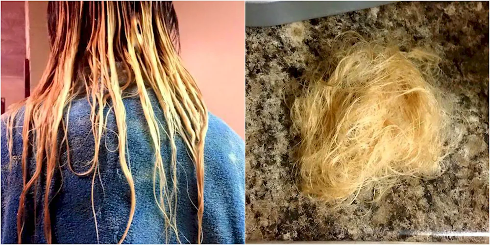 Burnt hair