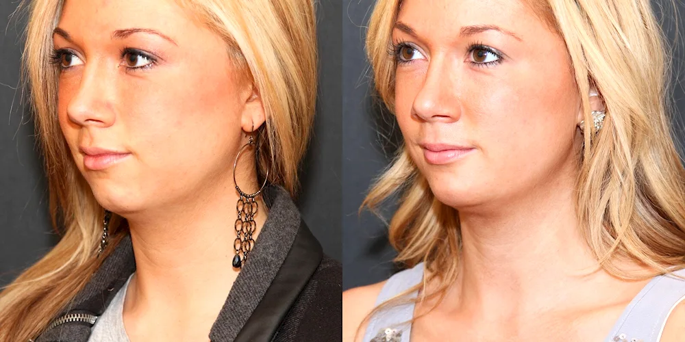 Bob haircut for round face Garson medium hair bob haircut for women
