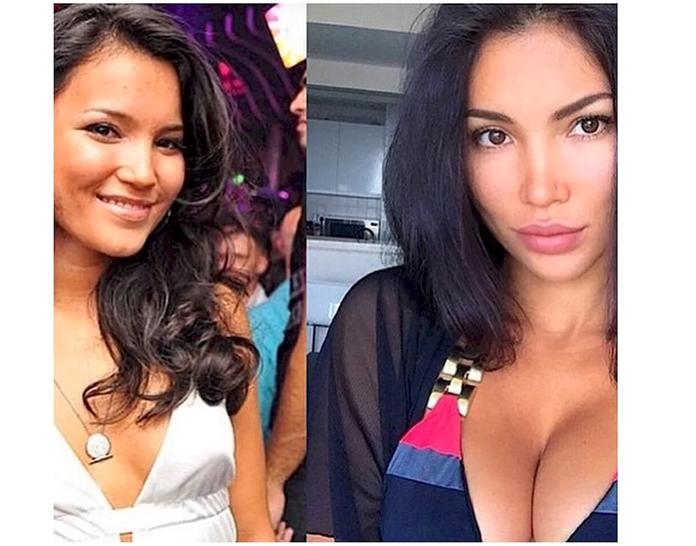 Svetla Bilyalova before plastic surgery