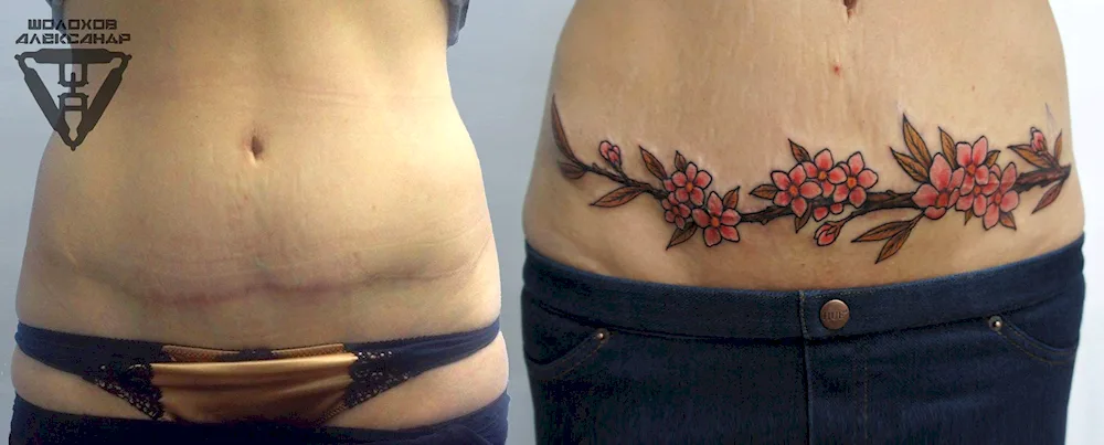 Tattoo on abdomen