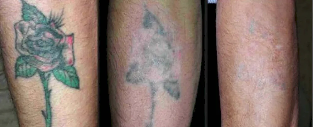 Tattoo before and after healing