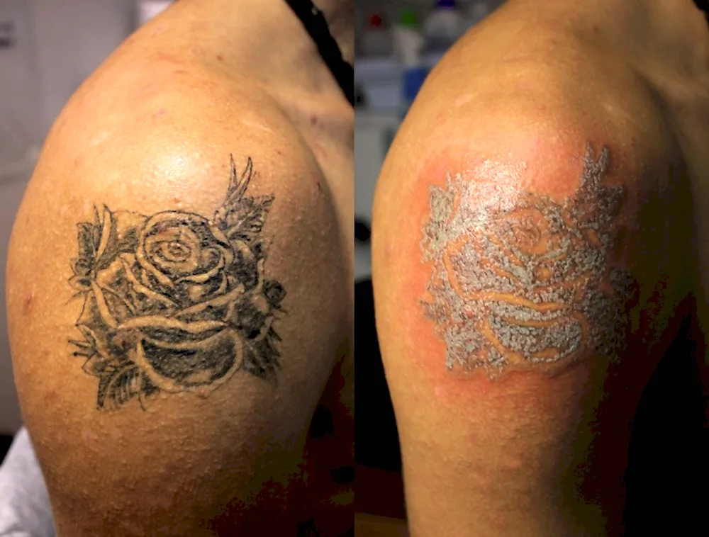 Tattoo healing under film