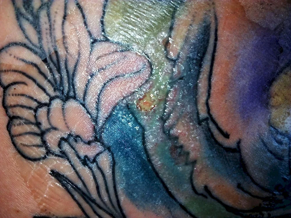 Tattoo crusting