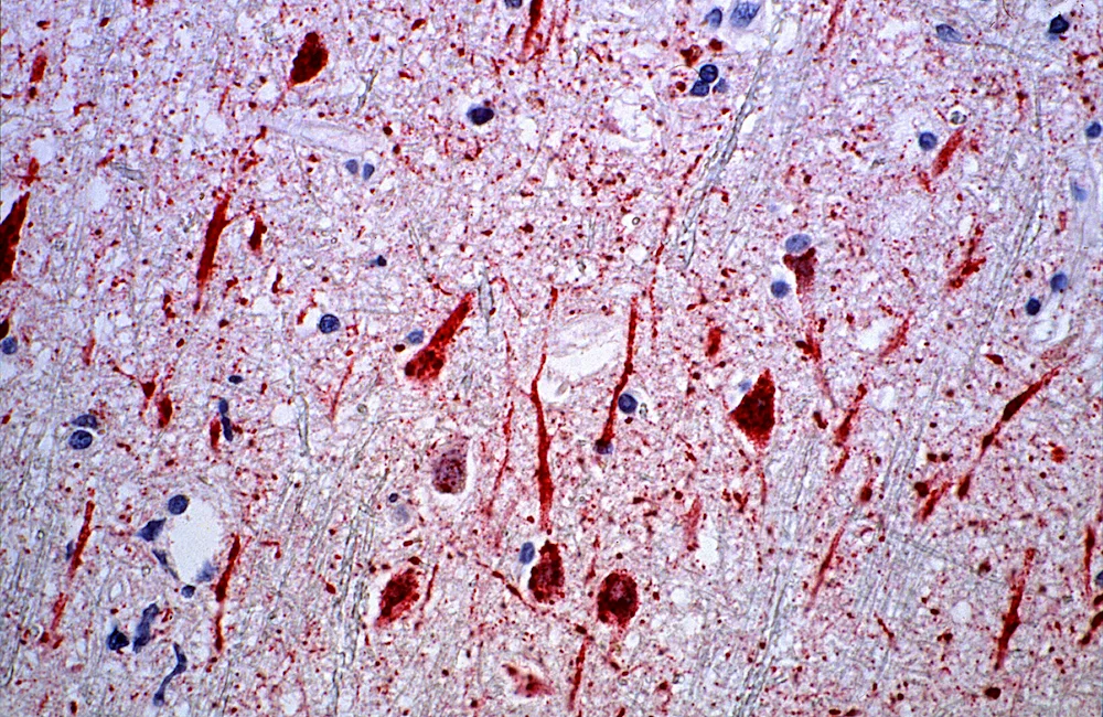 Chloroplasts of elodea