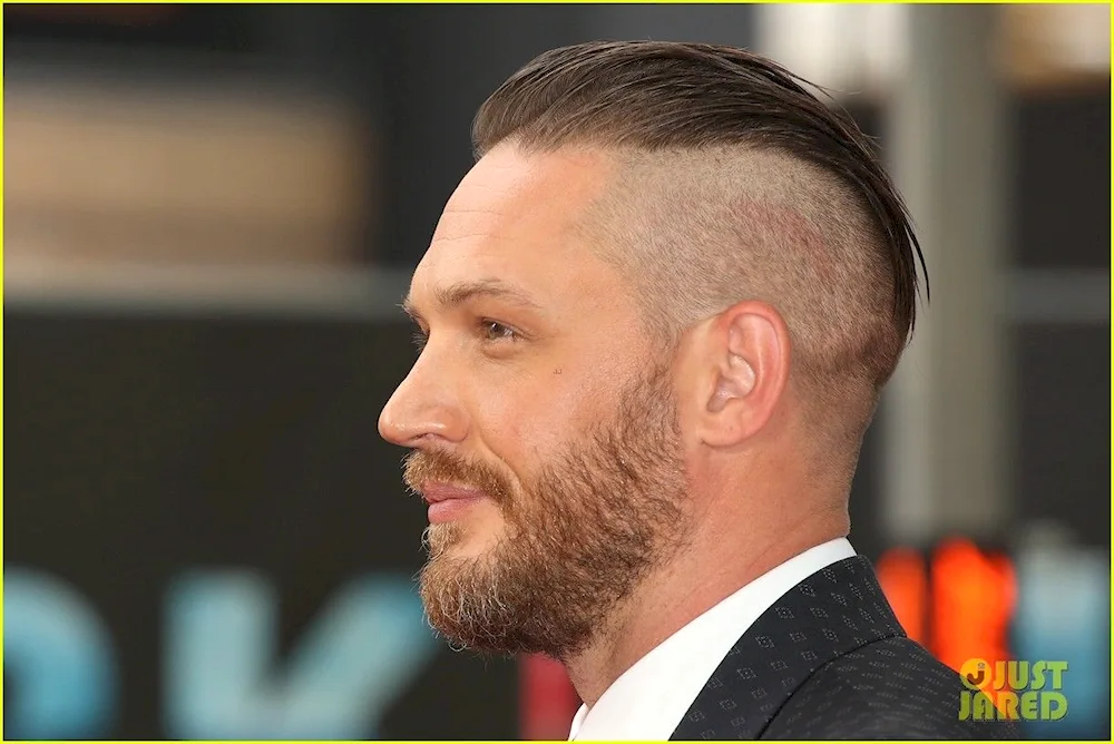 Androgen dependent alopecia