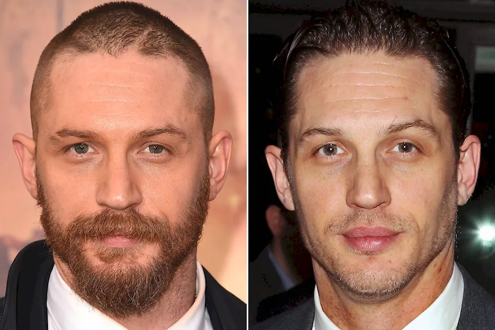 Tom Hardy