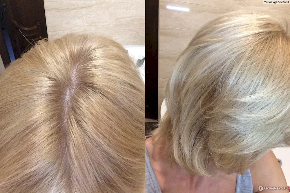 Prepigmentation of hair Blond