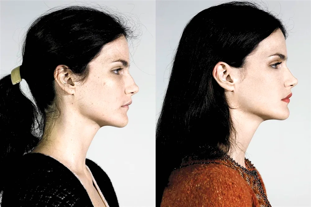 Thin nose with a hump