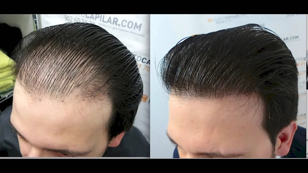 Men's medium hair hairstyles for men