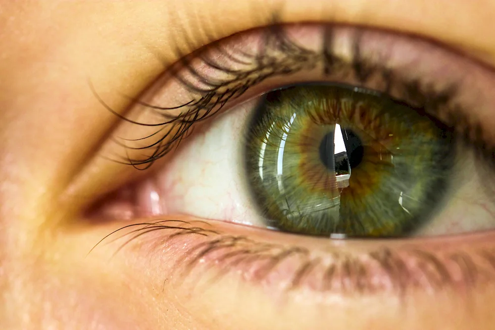 Central heterochromia green Karie
