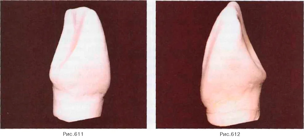 Central incisor of the mandible modelling