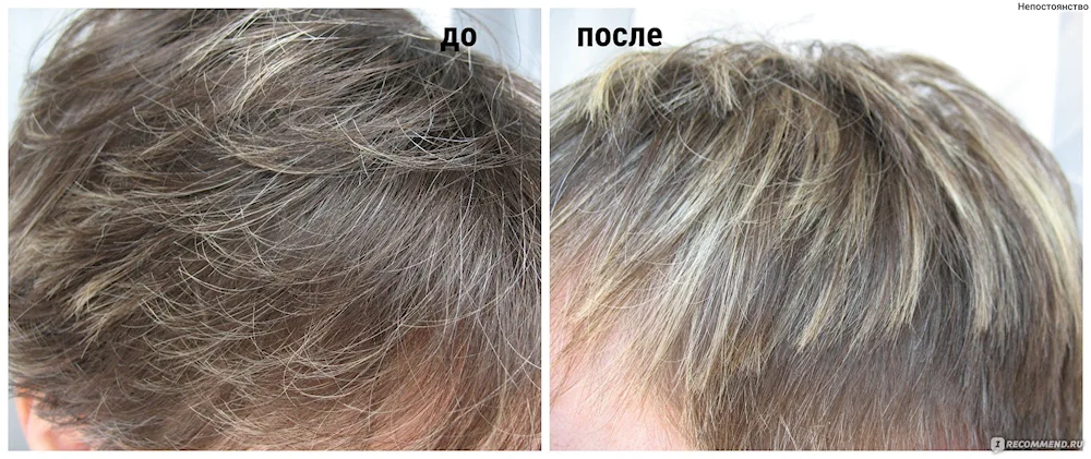 Hair colour