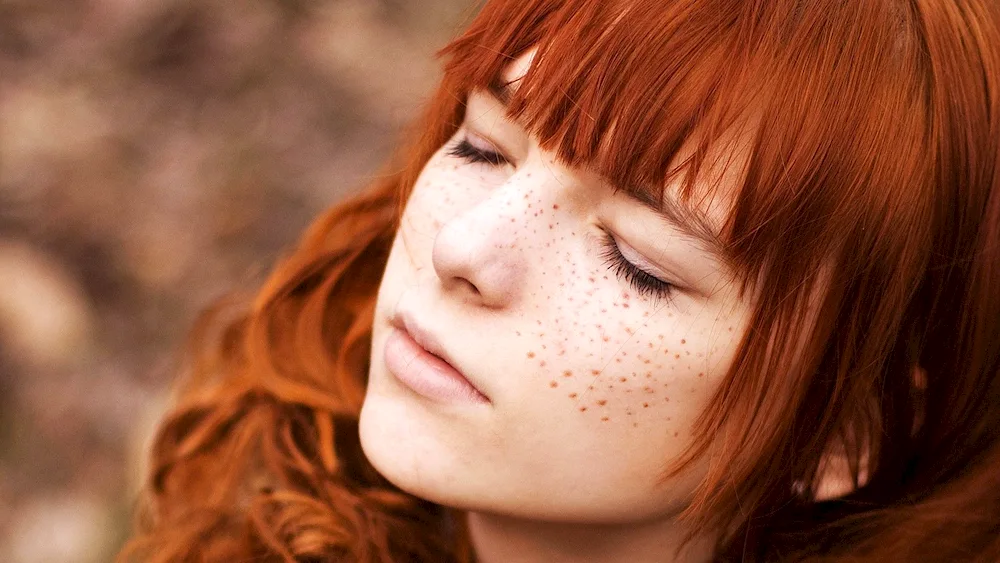 Emma Stone freckles