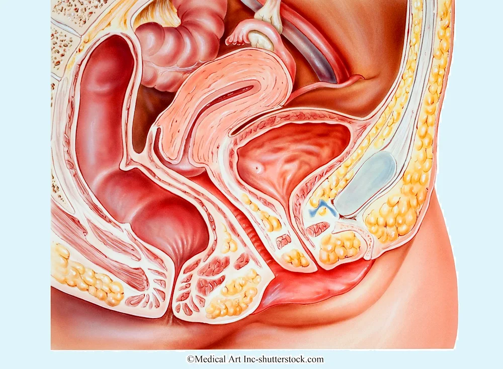 Adenectomy of the prostate gland