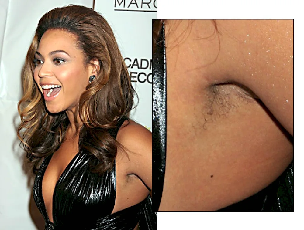 Alyssa Milano's hairy arms