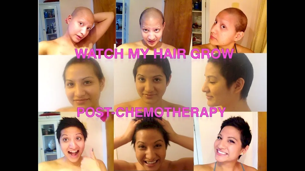 Hair cut after chemotherapy