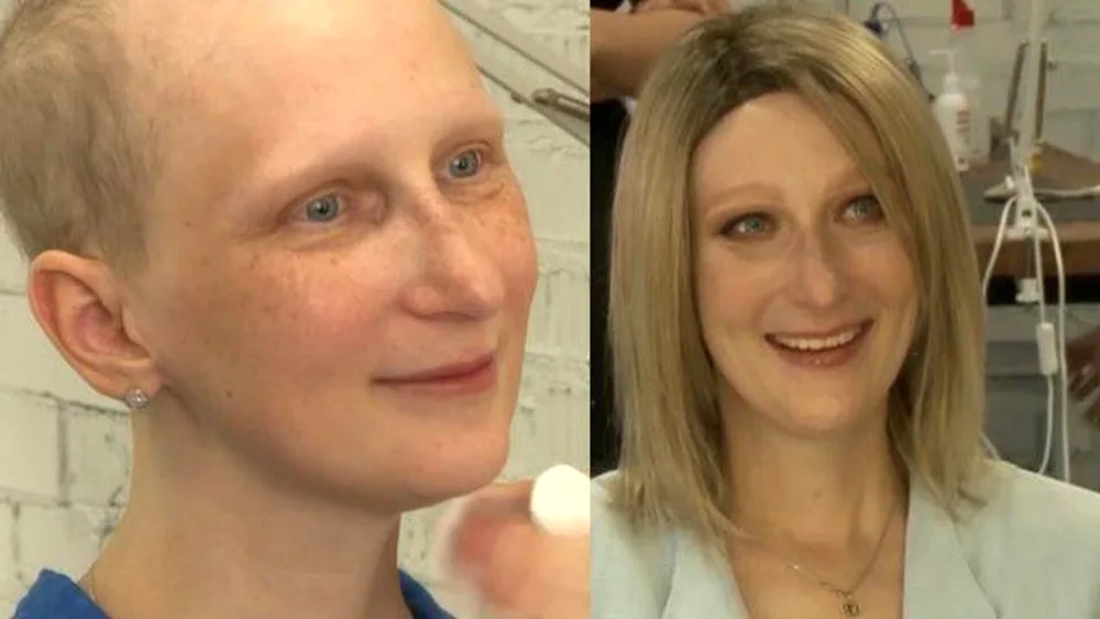 Hair cut after chemotherapy