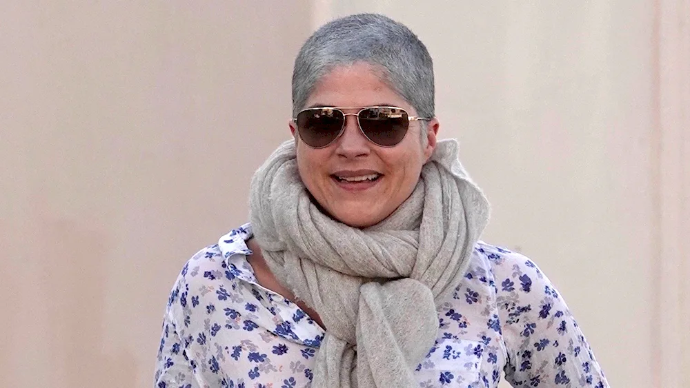 Total Alopecia in women