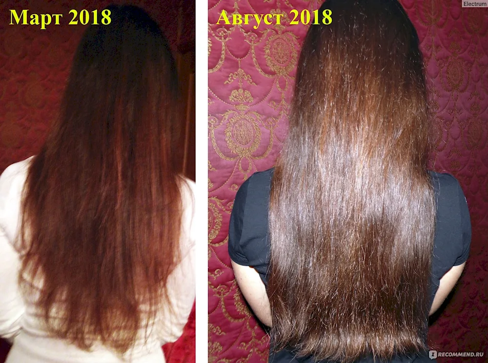 Grow hair fast