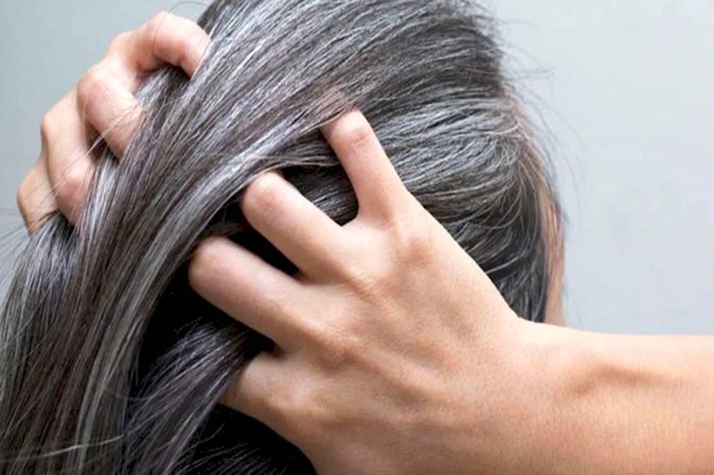 Fander Grey hair