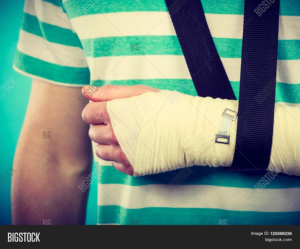 Bandaged arm of a man