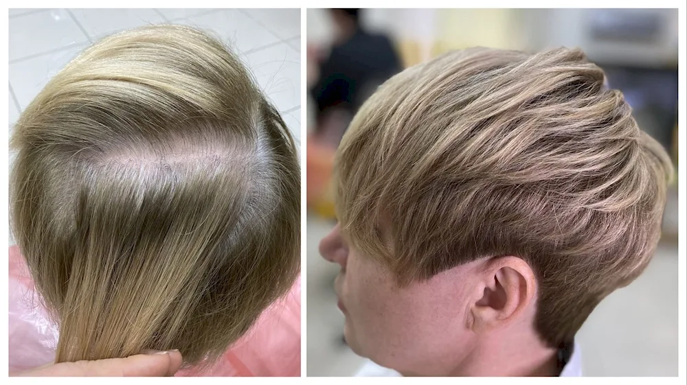 Tinting grey hair