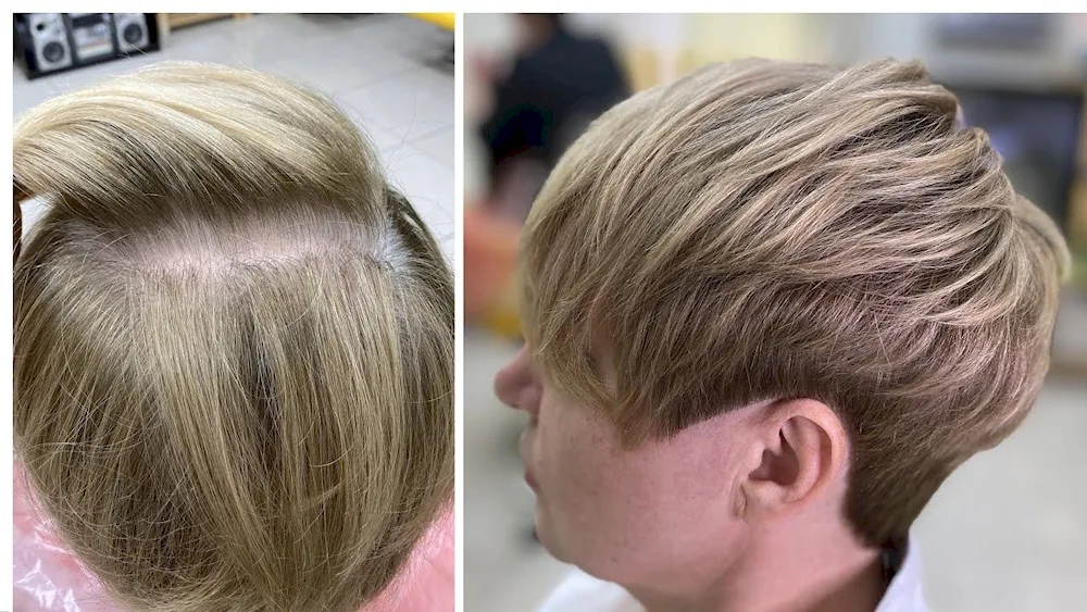 Grey hair dyeing