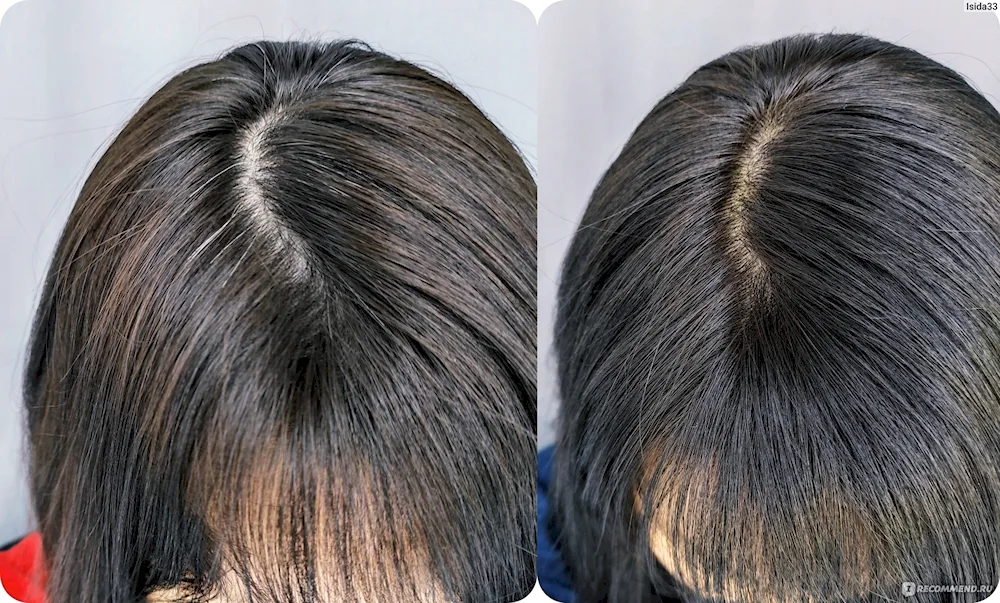 Laminating hair