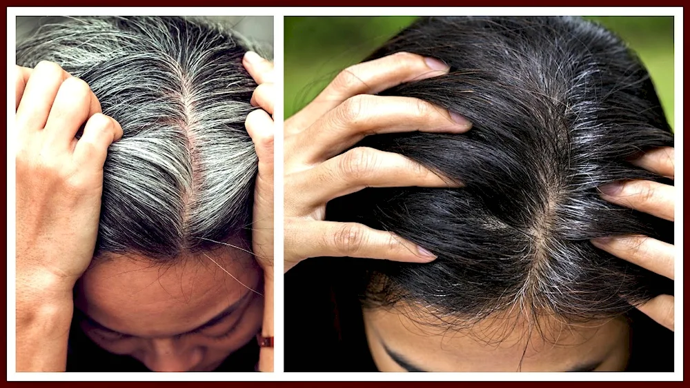 Beautifying Grey Hair