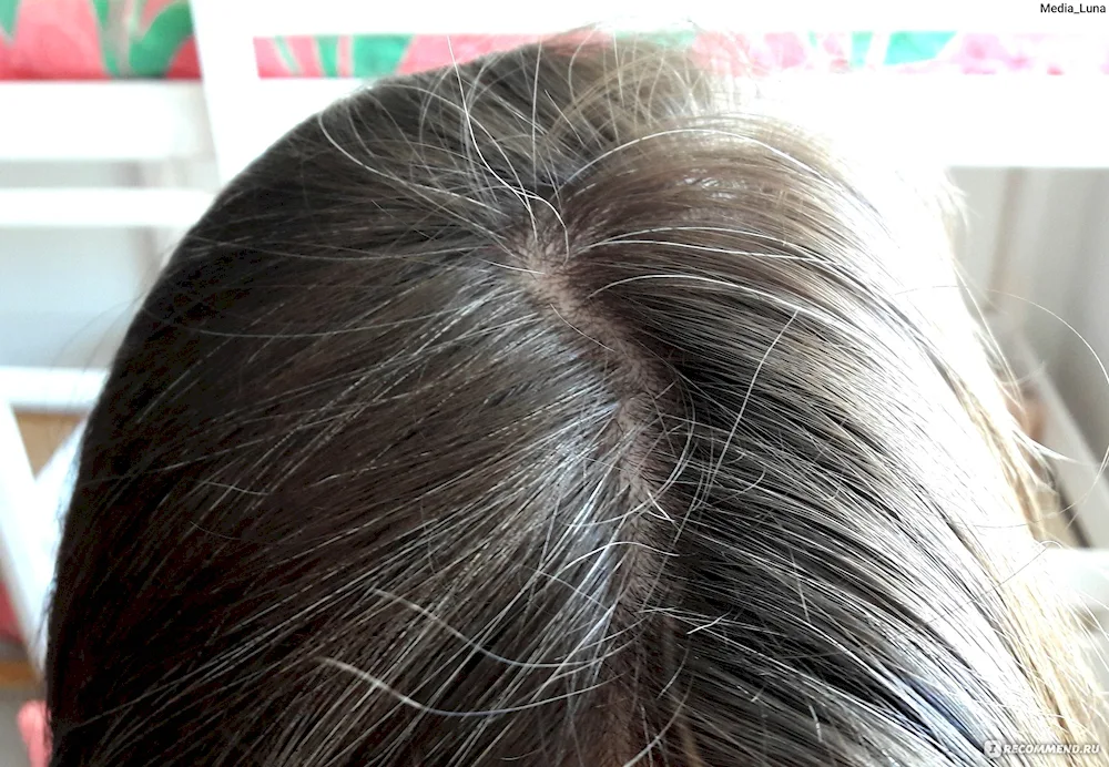 Grey Hair