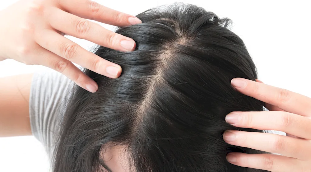 Healthy scalp