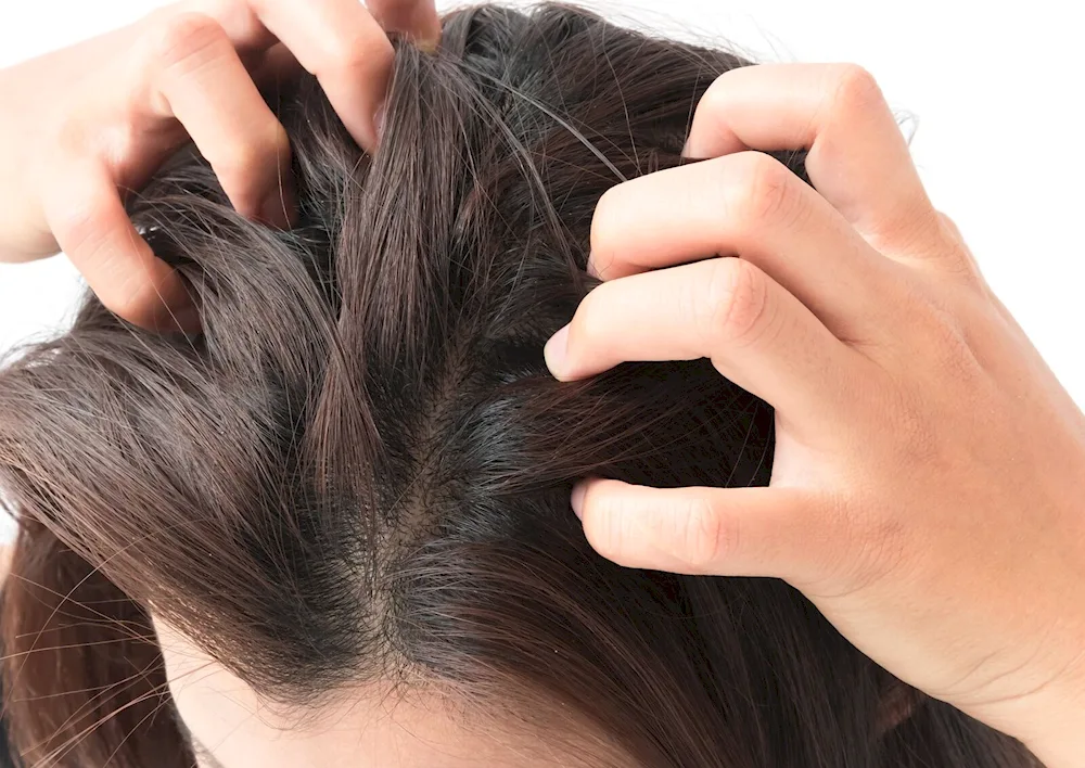 Healthy scalp