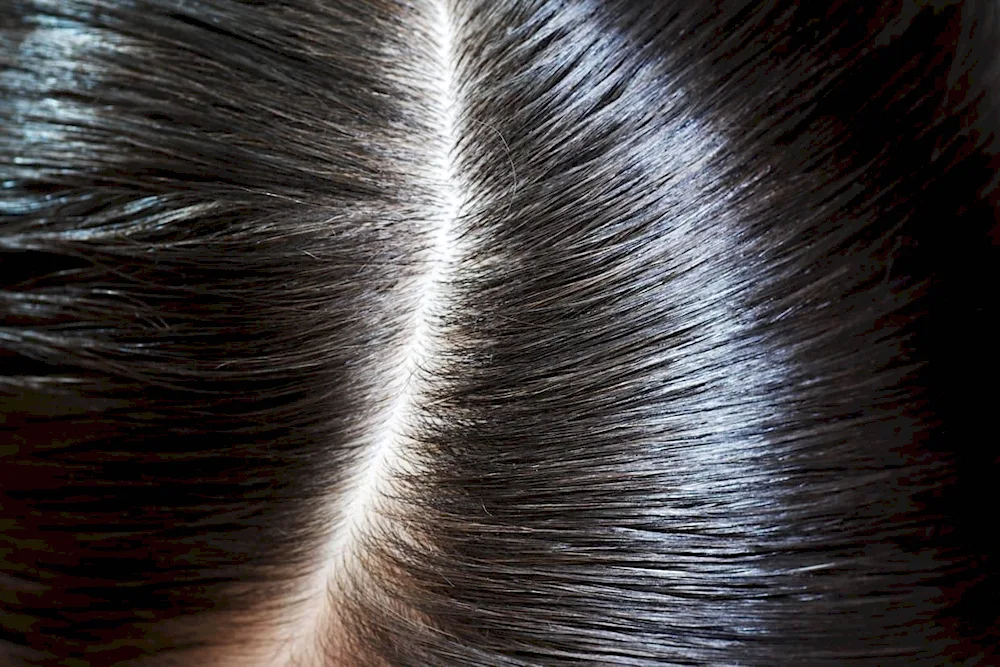 Healthy scalp parting