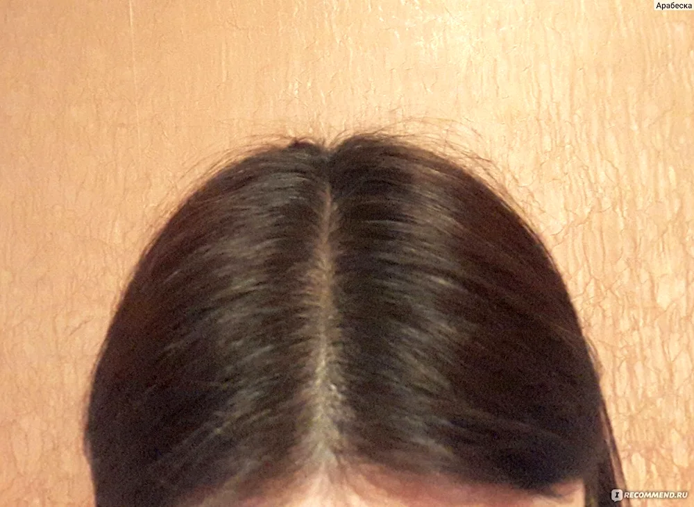 Healthy scalp parting