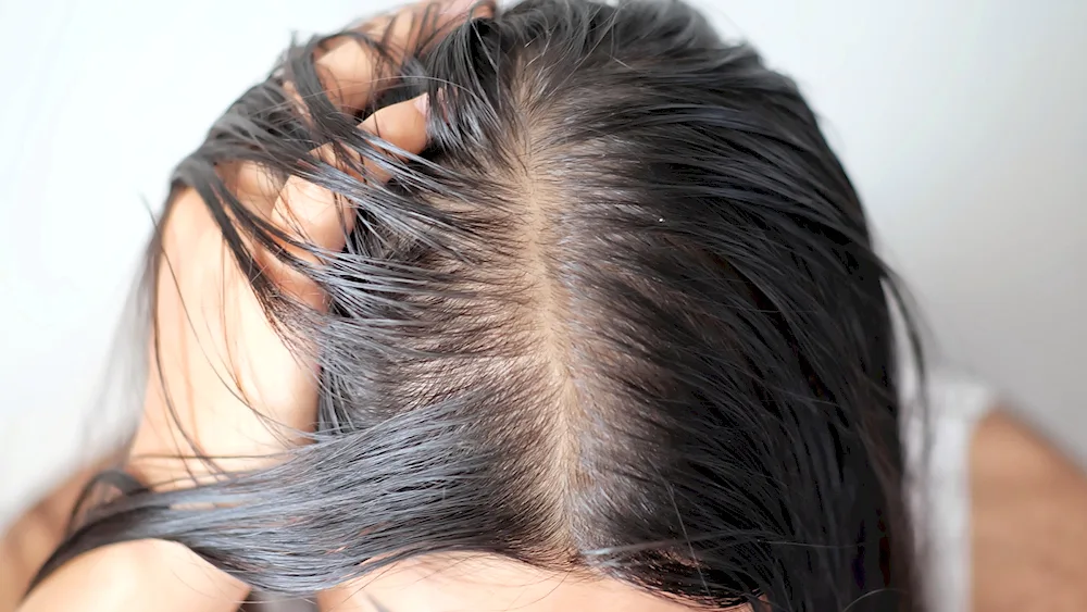 Oil hair